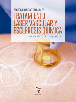 Protocolo de actuación en el tratamiento láser vascular y esclerosis química