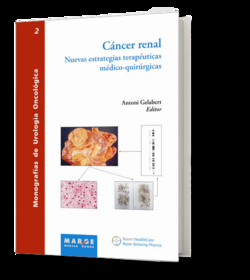 Cáncer renal