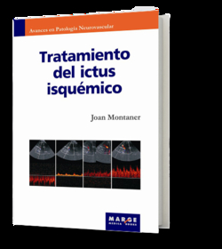 Tratamiento del ictus isquémico