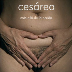 Cesárea