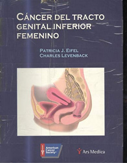CANCER DE TRACTO GENITAL INFERIOR FEMENINO