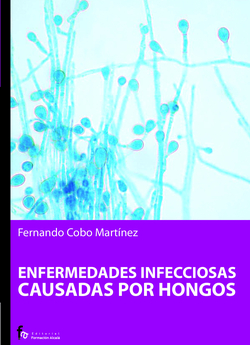 Enfermedades infeciosas causadas por hongos