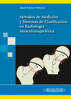 Métodos de Medición y Sistemas de Clasificación en Radiología Musculoesquelética,