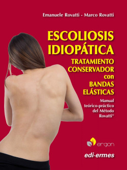 Escoliosis idiopática. Tratamiento conservador con bandas elásticas
