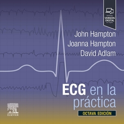 Ecg en la practica