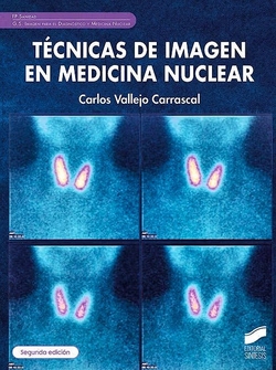 Técnicas de imagen de medicina nuclear